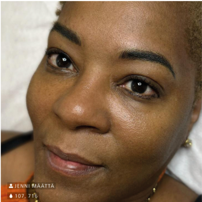 Resultado de micropigmentación de cejas con Swiss Color 716 Midnight Brown en piel oscura, marrón frío intenso de efecto definido, elegante y natural